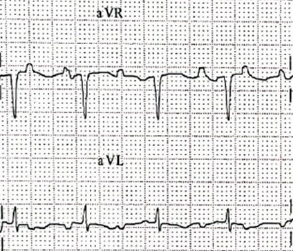 XVI_15index