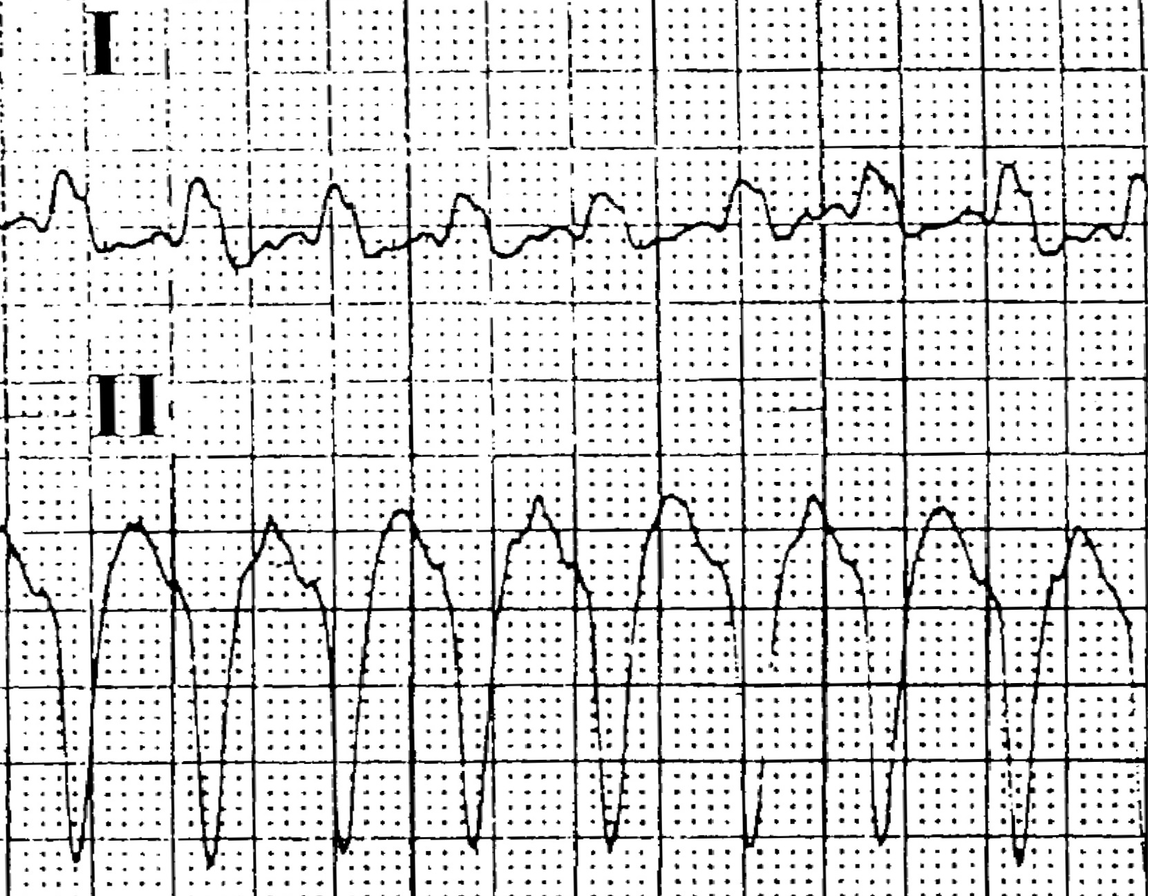 XVI_4index