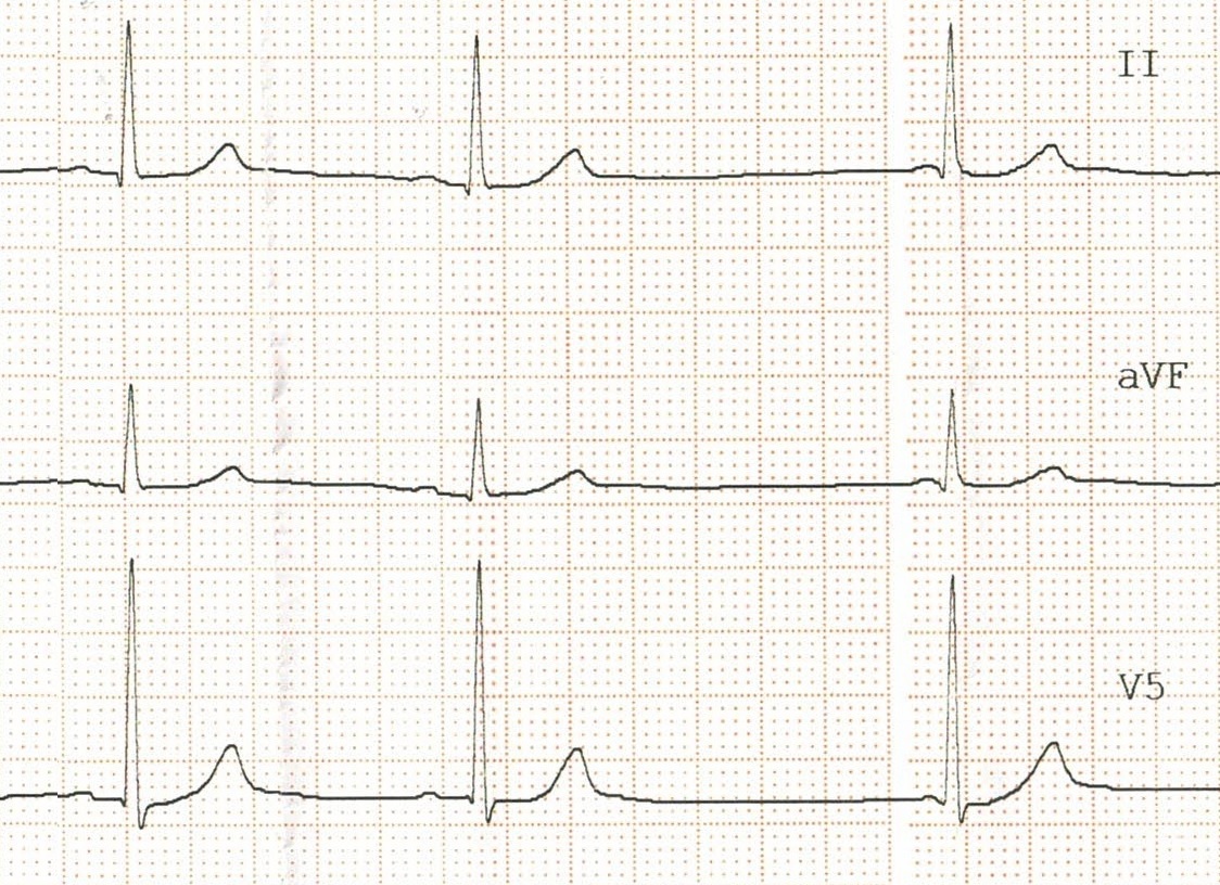 XVI_4index