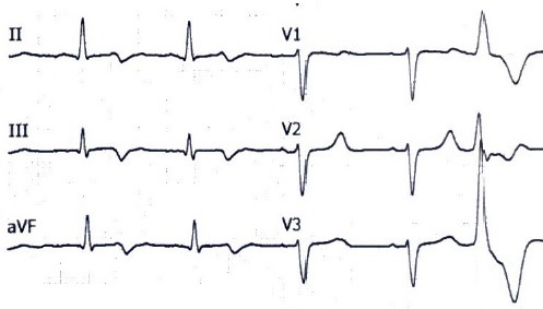 XVI_7index